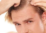 Bí quyết đơn giản trị gàu cho tóc nam.