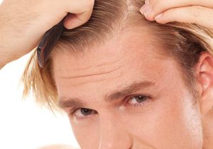Bí quyết đơn giản trị gàu cho tóc nam.
