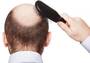 6 mẹo tạo kiểu để giảm thiểu rụng tóc ở nam giới
