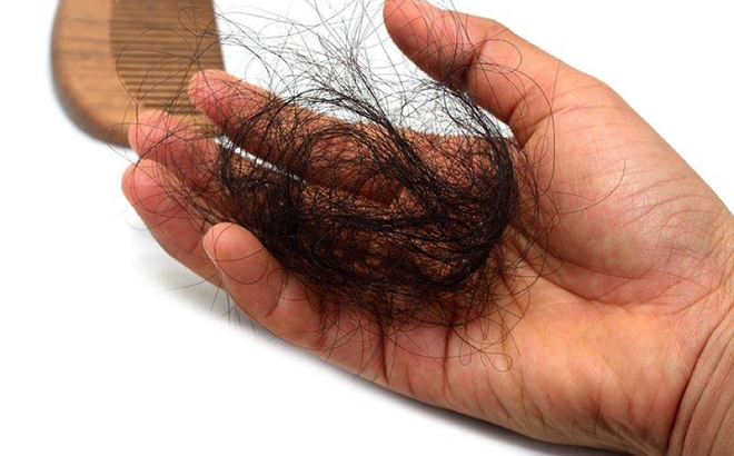 Làm thế nào để sử dụng gel mà không rụng tóc? Bạn phải kết hợp thêm các phương pháp dưỡng tóc từ thiên nhiên.