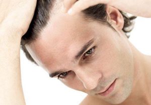 6 nguyên nhân khiến tóc nam rụng nhiều.