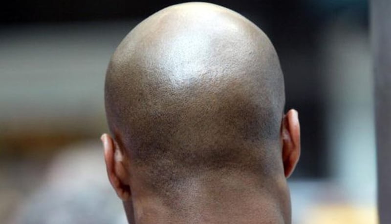 Bald Head 